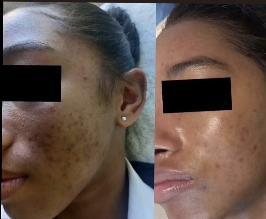 Skin Renewal client transformation