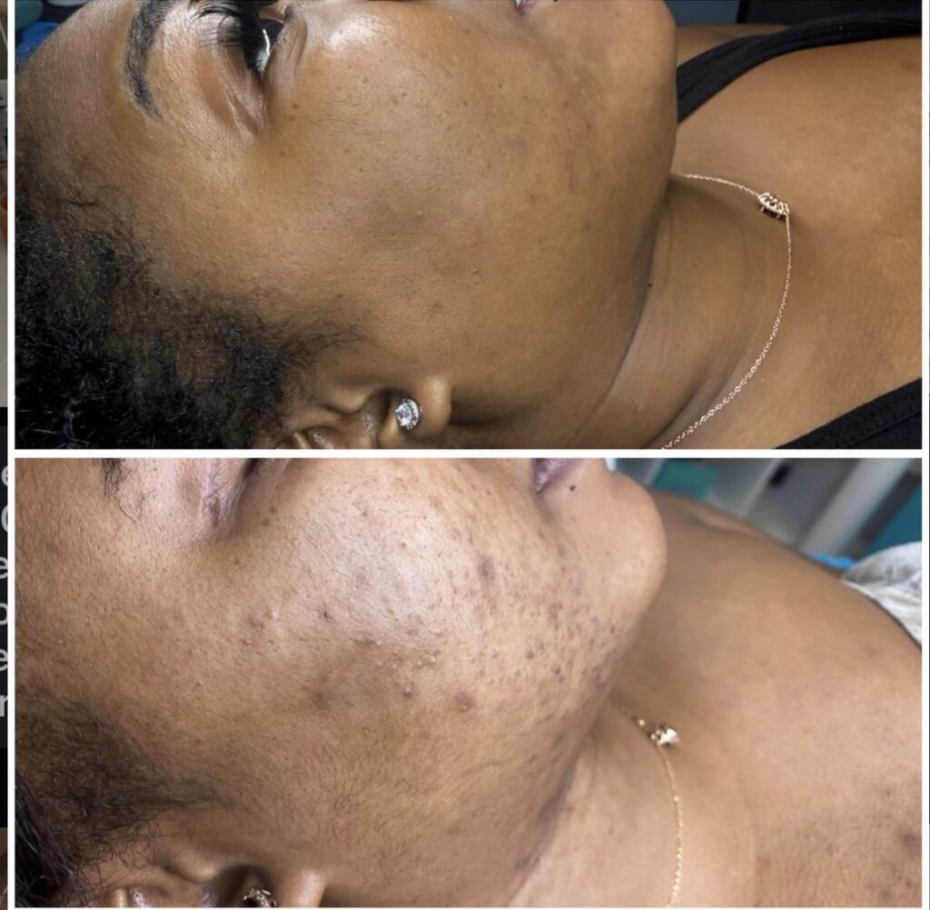 Facials & Peels — client progress