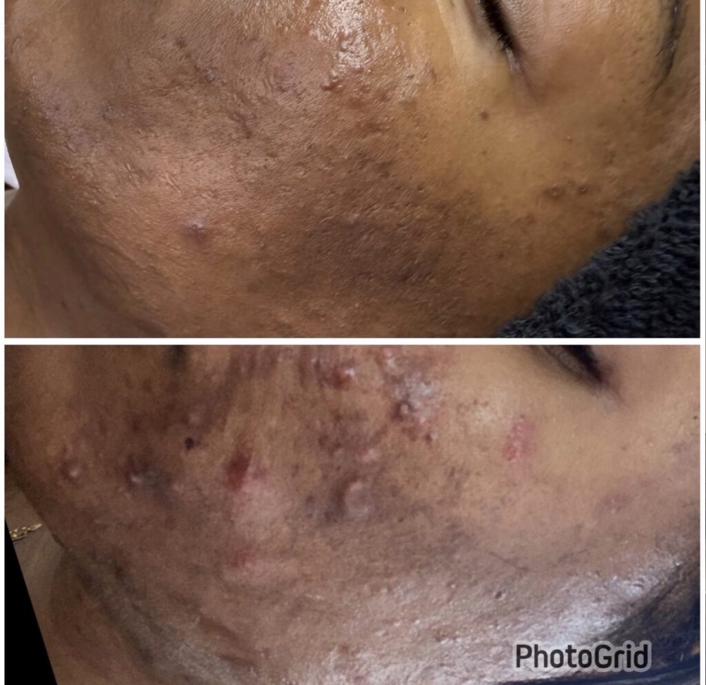 Facials & Peels — client progress